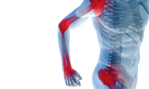 Кои храни вредят на ставите и защо трябва да внимаваме с тях?