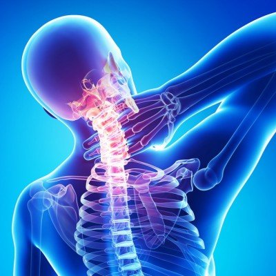 Остеохондроза – характерни симптоми и признаци