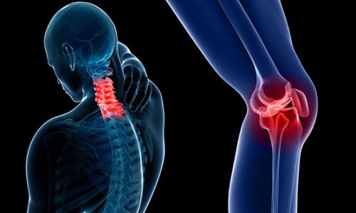 Възпаление на ставите: причини и лечение