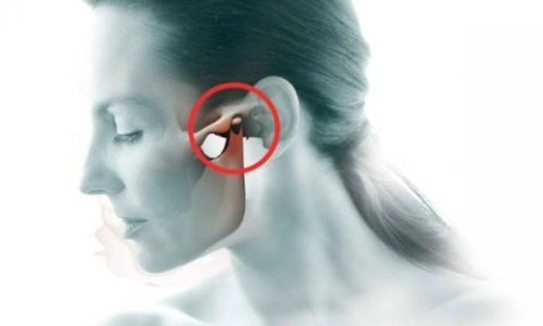 Артроза на челюстната става – защо се развива, как протича?