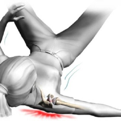 Разместване на раменна става – как да го познаем и какво да правим?