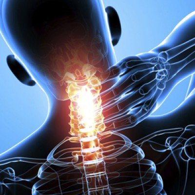 Разместване на шиен прешлен – причини, признаци, лечение