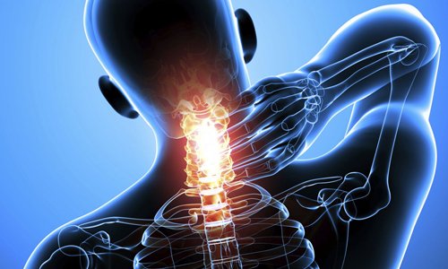 Разместване на шиен прешлен – причини, признаци, лечение