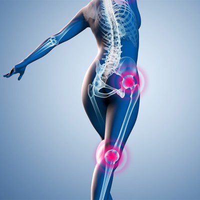 Спорт при артроза: кои са полезните спортове за стави?