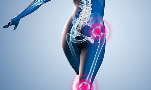 Спорт при артроза: кои са полезните спортове за стави?