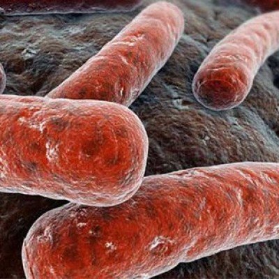 Туберкулоза на костите – механизъм на развитие, признаци, методи за лечение