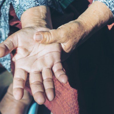 Артроза на пръстите на ръцете