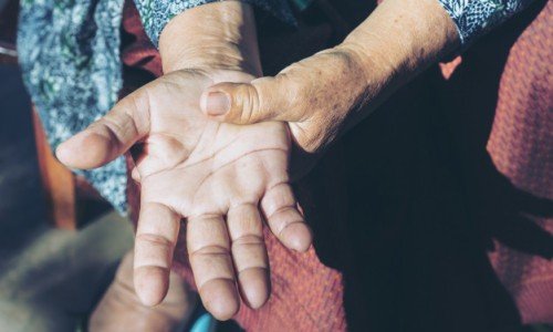 Артроза на пръстите на ръцете