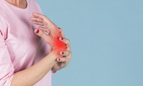 Митове за артритите