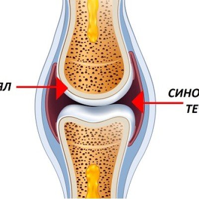Синовиална (ставна) течност – за какво служи и къде се намира? – 2 част