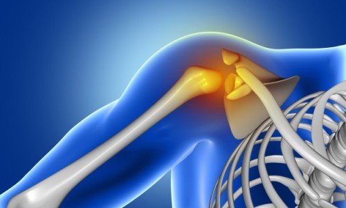 10 от най-добрите рецепти при болки в ставите