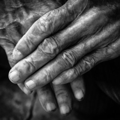 Артрит на пръстите на ръцете – ефективно народно лечение