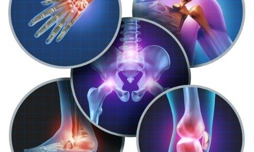 CBD - помага ли при артрит и болки в ставите?