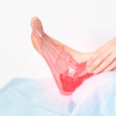 Разтегнати връзки на глезена: кога и защо?