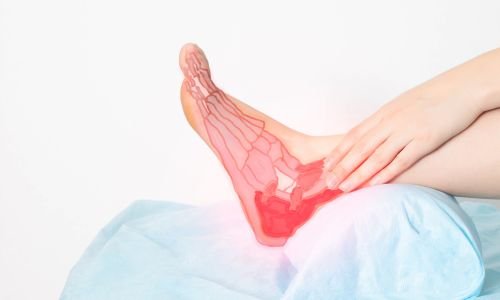 Разтегнати връзки на глезена: кога и защо?