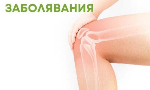 Какво трябва да знаем за костните заболявания